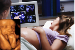 Tuổi thai siêu âm lớn hơn tuổi thai chu kỳ kinh có sao không?
