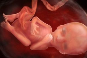 Bà bầu thiếu sắt ảnh hưởng gì đến thai nhi?