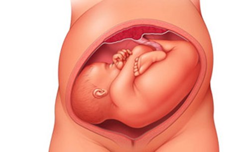 Huyết sắc tố thấp ở trẻ sơ sinh có nguy hiểm không?