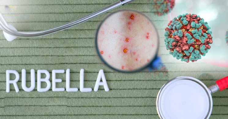 Bà bầu bị sốt rubella có nguy hiểm không?