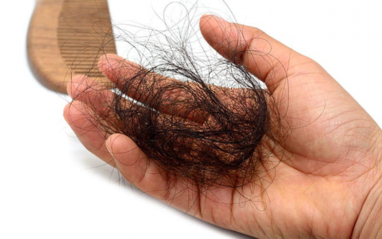 Rụng tóc sau sinh nội tiết là như thế nào, có tự khỏi không?