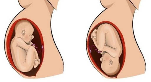 Mang thai 38 tuần tử cung mở 2cm bao giờ sinh?