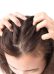 3 cách chữa rụng tóc sau sinh bằng hành tây