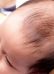 Rụng tóc ở trẻ sơ sinh 1 tháng tuổi là do đâu?