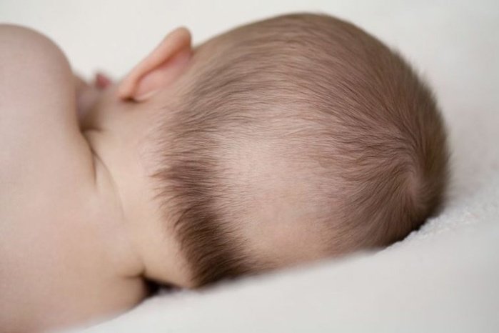 Trẻ sơ sinh bị rụng tóc là thiếu chất gì?