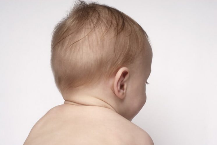 Trẻ sơ sinh bị rụng tóc máu có phải là bình thường?