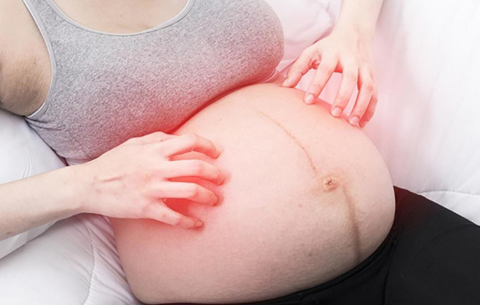 5 cách làm giảm ngứa khi mang thai an toàn cho mẹ