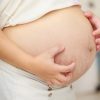 Bụng bị ngứa khi mang thai là do đâu?
