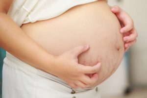 Bụng bị ngứa khi mang thai là do đâu?