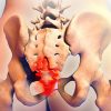 4 bài tập giảm đau xương chậu sau sinh