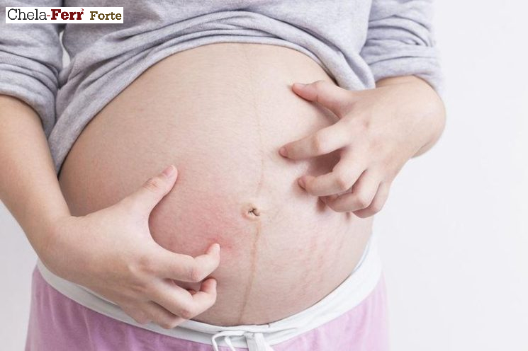 Bị ngứa khi mang thai 3 tháng giữa có sao không?