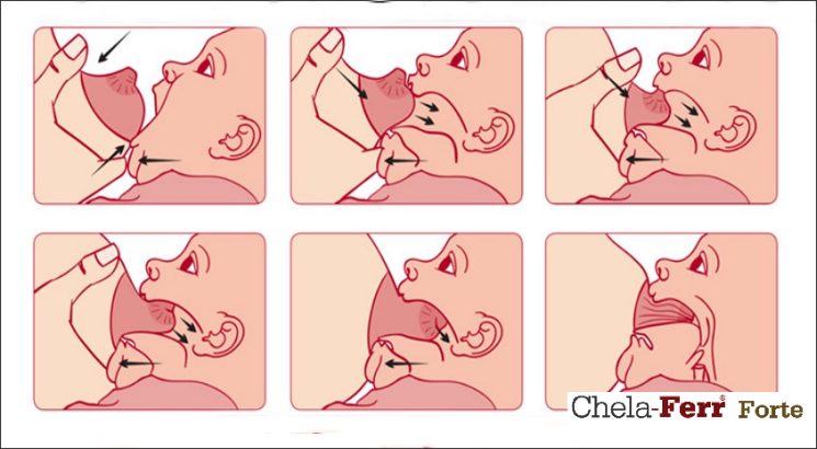5 cách phòng bệnh nứt cổ gà cho mẹ sau sinh