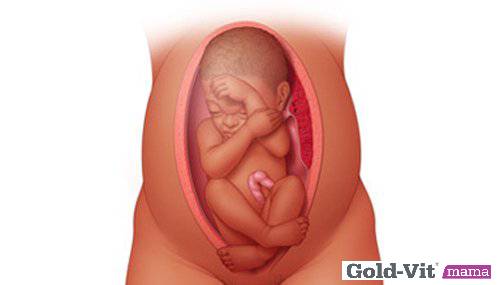 Cách xoay ngôi thai ngược và những điều mẹ nên chú ý