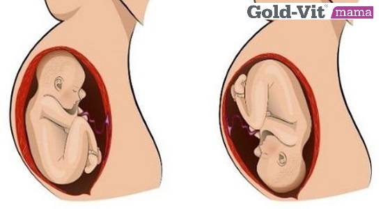 Ngôi thai ngược có sinh thường được không?
